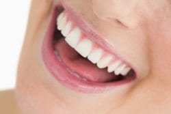 Brighten Dull Teeth With Professional Teeth Whitening