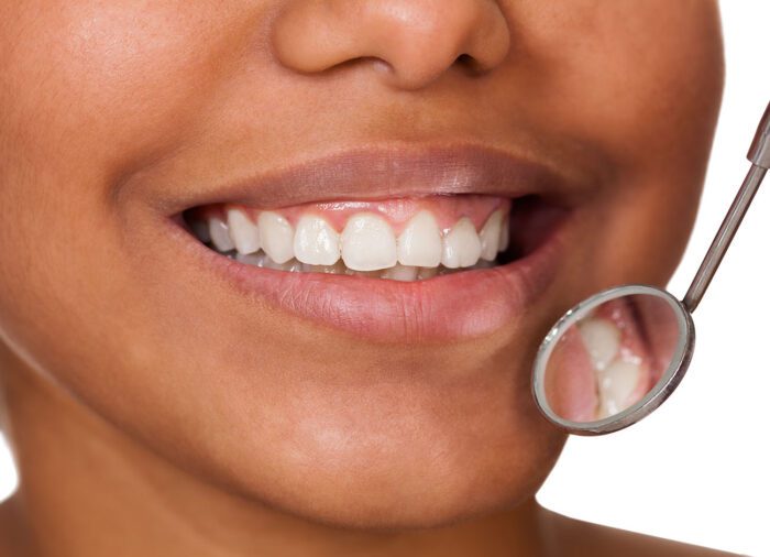 Gum Disease in Cohoes NY could affect your overall health