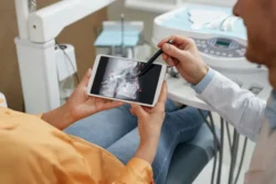What Happens During a Root Canal? in Cohoes NY